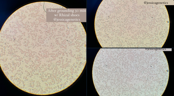 Do Grounding Shoes Really Work? A Geneticist Tested RHIZAL — Here’s What Happened to Her Blood